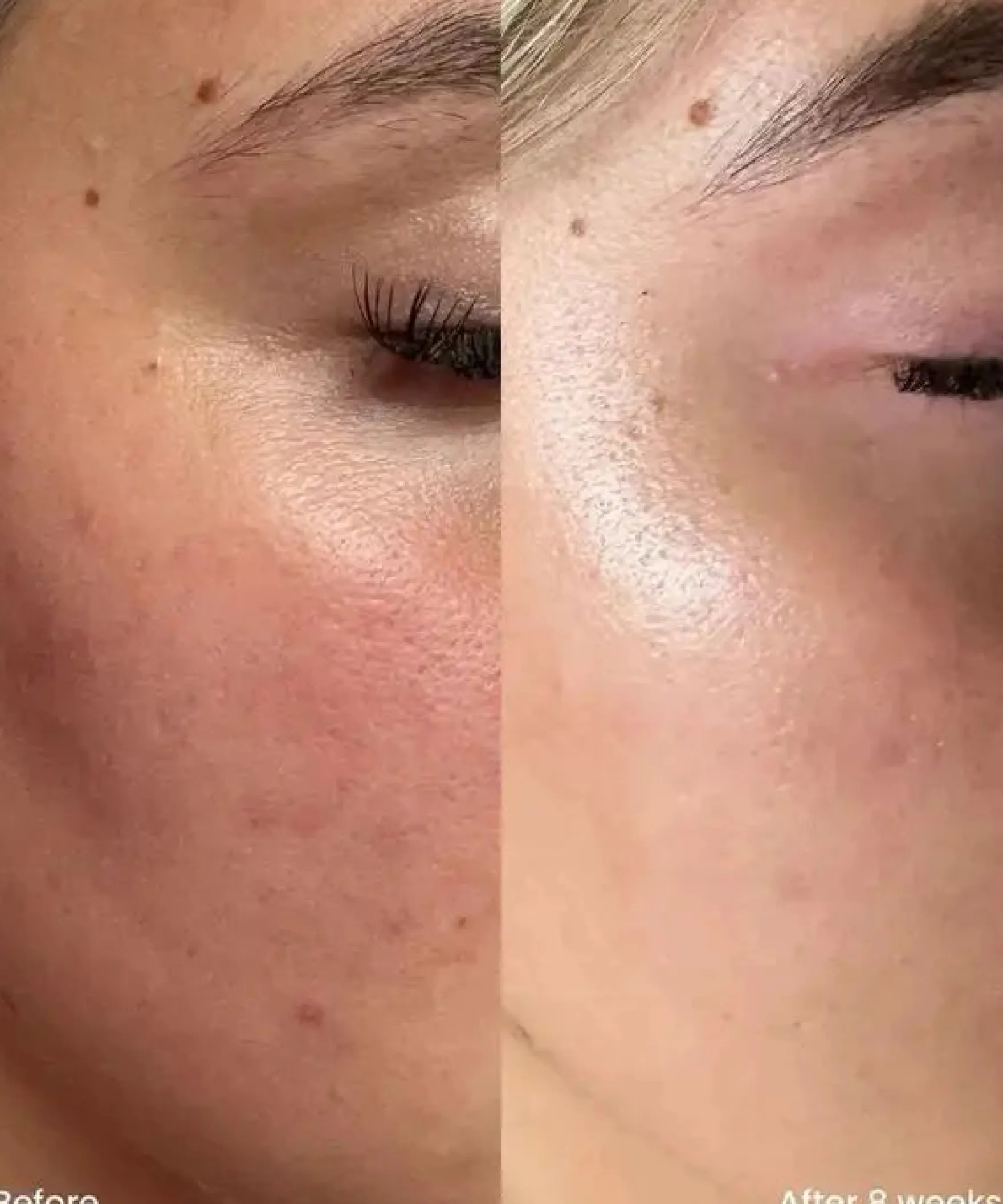 10% Niacinamide Treatment Serum