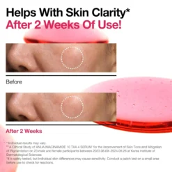 Niacinamide 10% + TXA 4% Dark Spot Correcting Serum