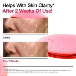 Niacinamide 10% + TXA 4% Serum 10 ml.