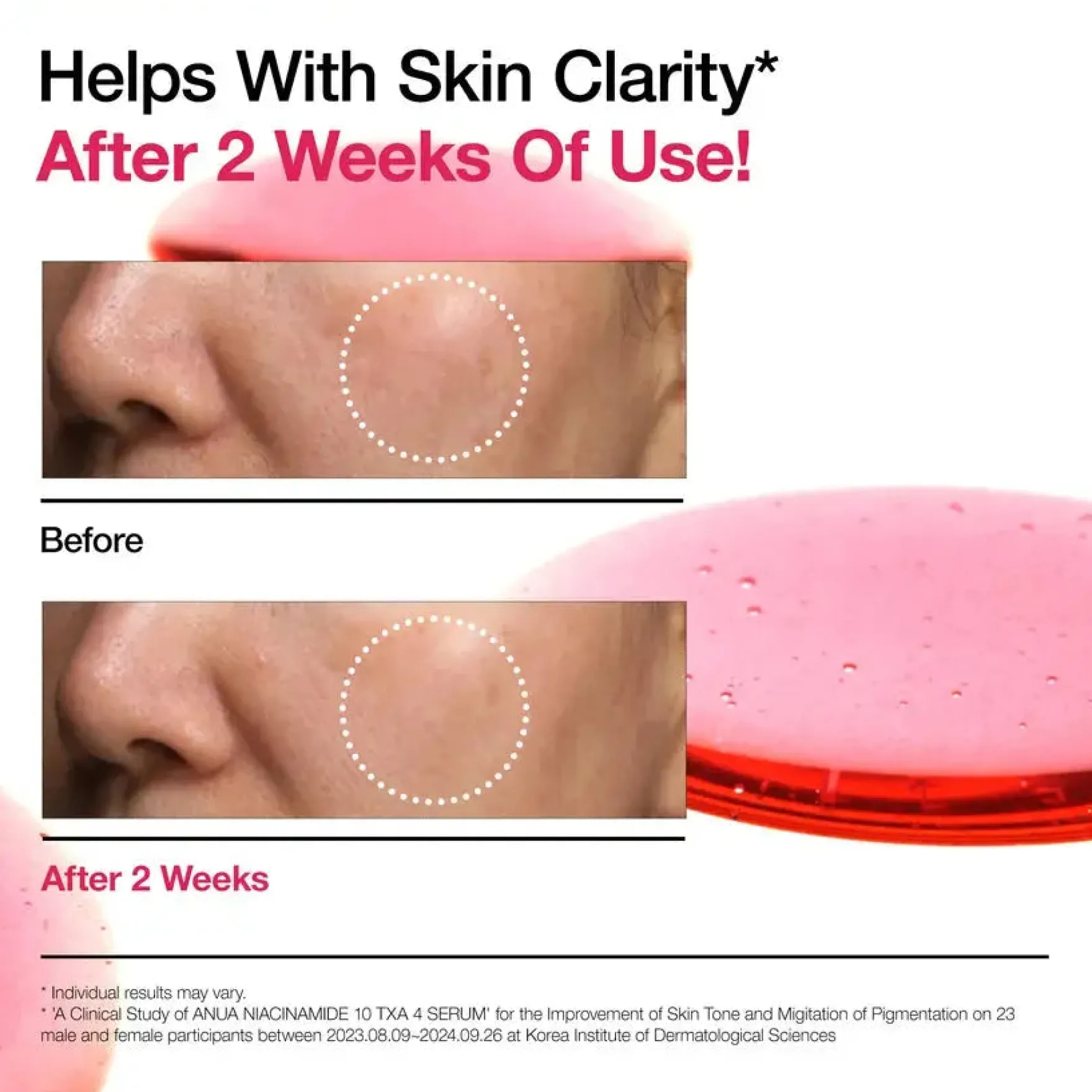 Niacinamide 10% + TXA 4% Serum 10 ml.