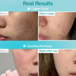 No.1 Pantothenic B5 Hyaluronic Active Clear Mask