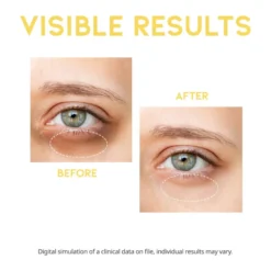 OOTD Dark Circle Eye Serum