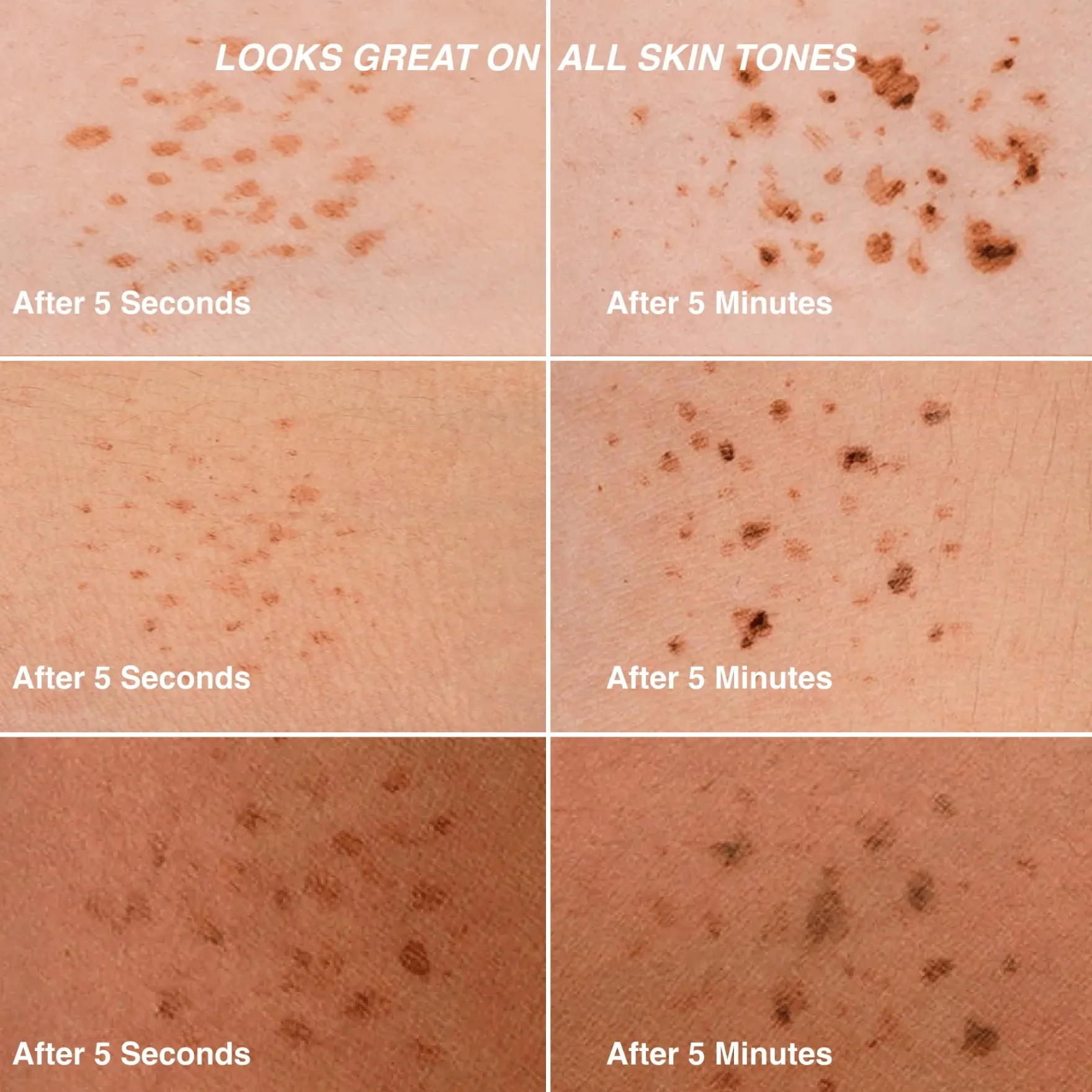 Original Faux Freckles