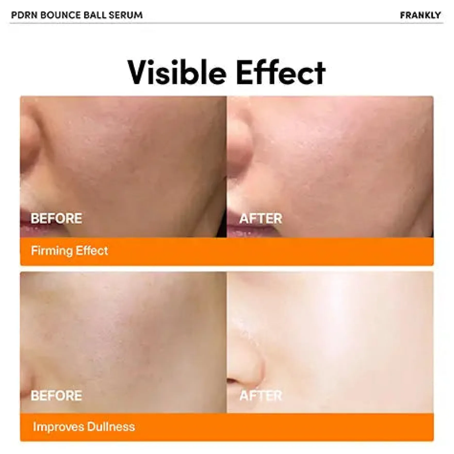 PDRN Bounce Ball Serum