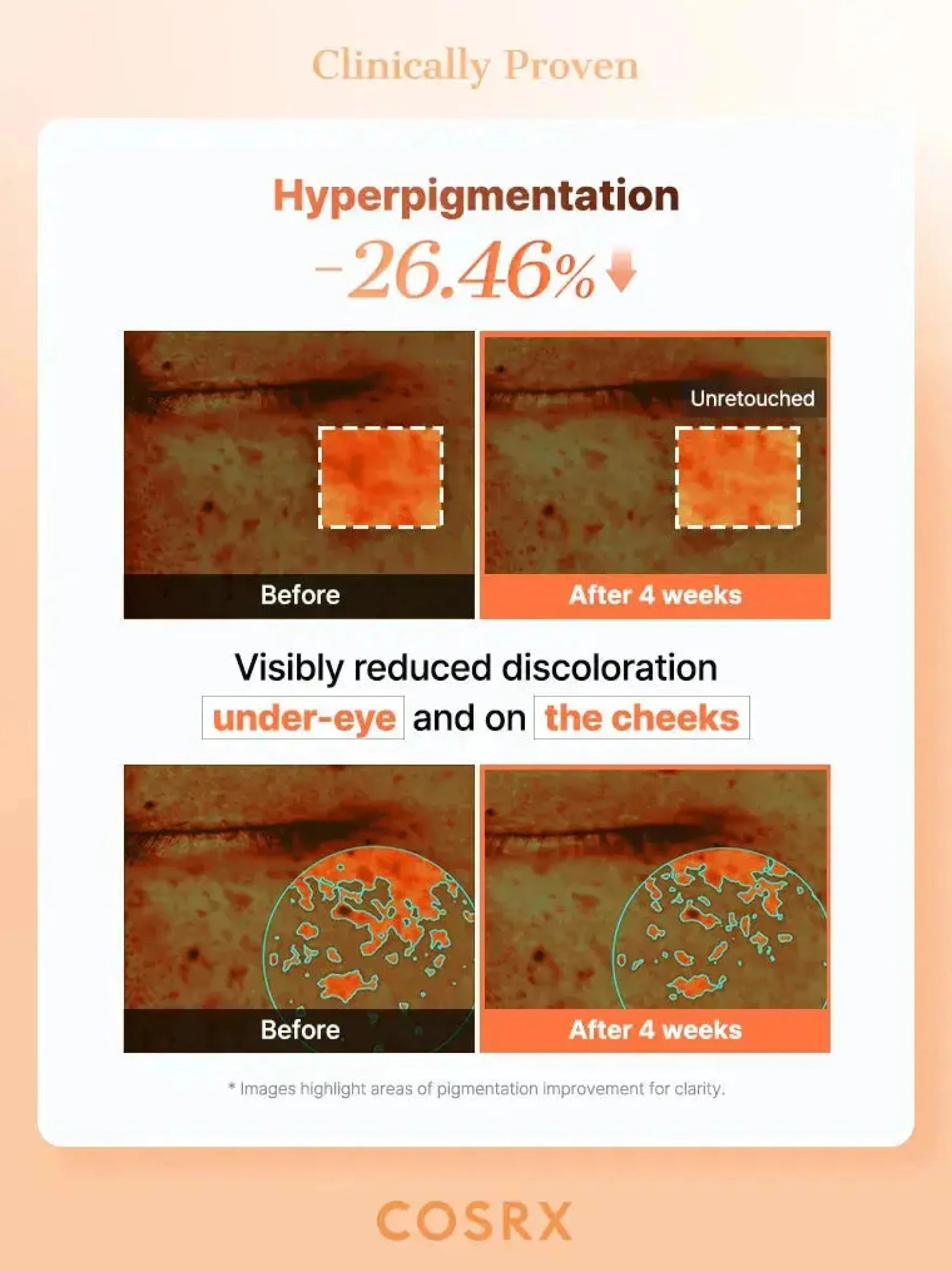 5 PDRN Collagen Vitalizing Hydrogel Eye Patch