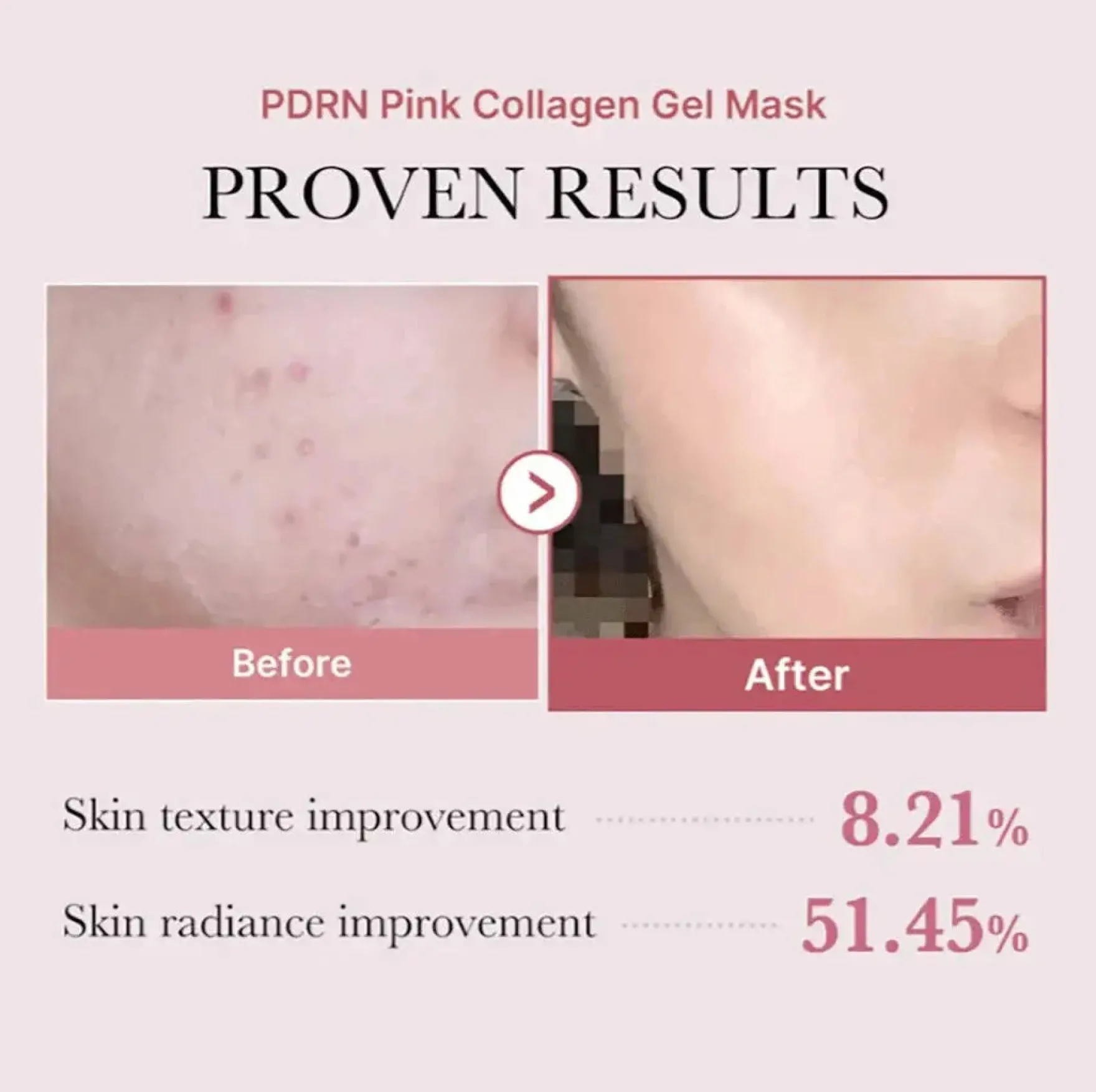Pdrn Pink Collagen Gel Mask 4-Pack
