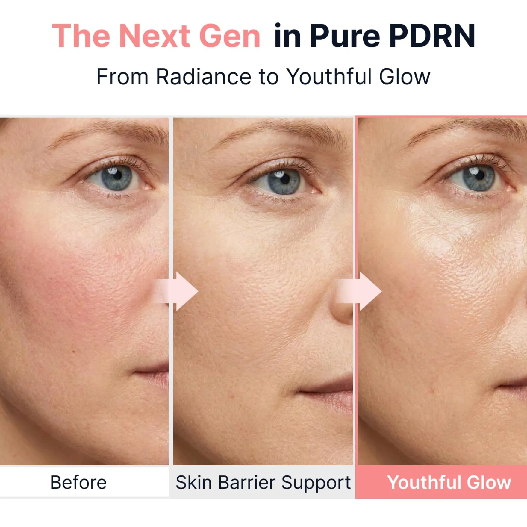 PDRN Pink Vitamin Glow Boosting Ampoule