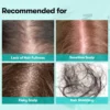 PDRN Reedle Shot Brush Hair Serum