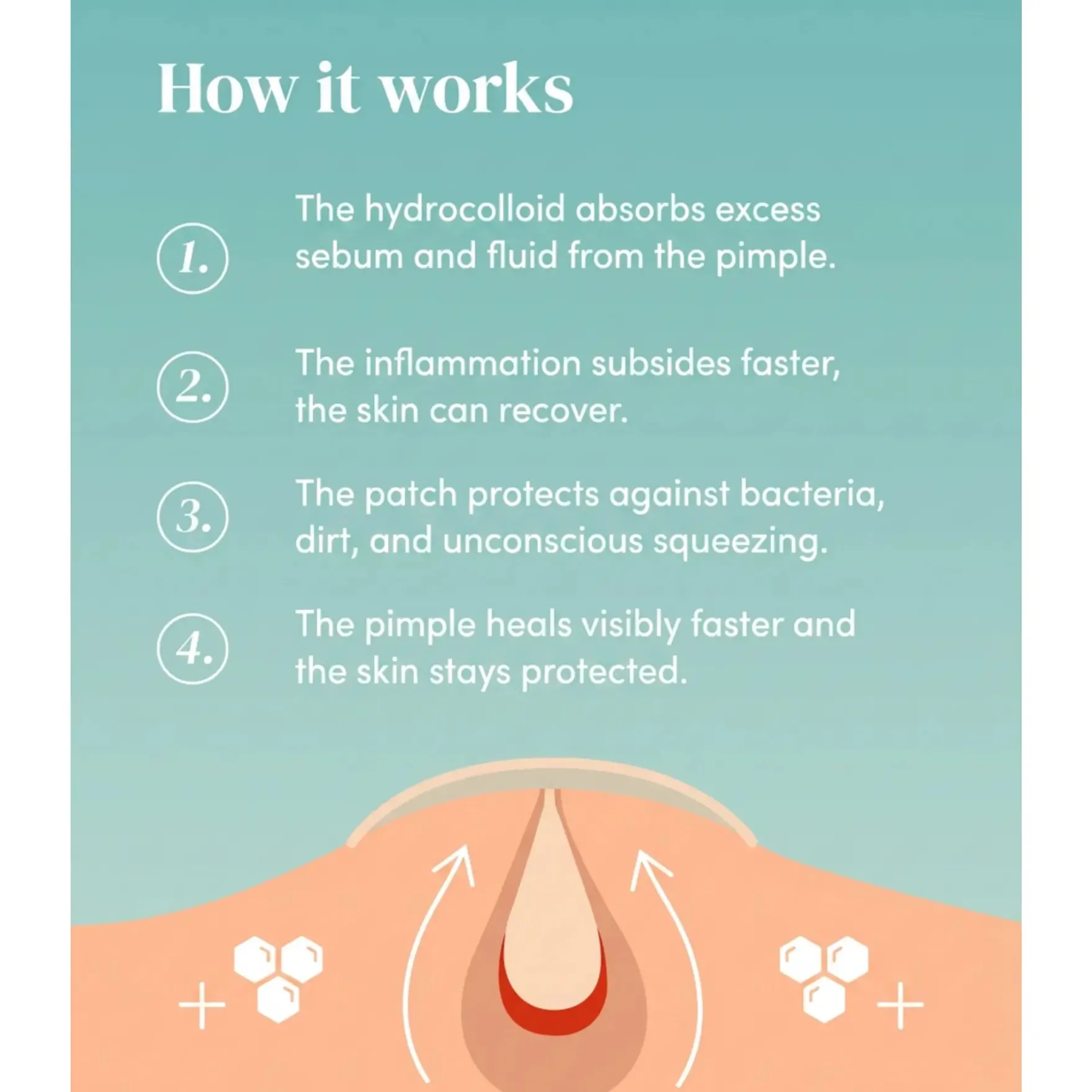 Pimple Patches