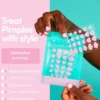 Pimple Patches
