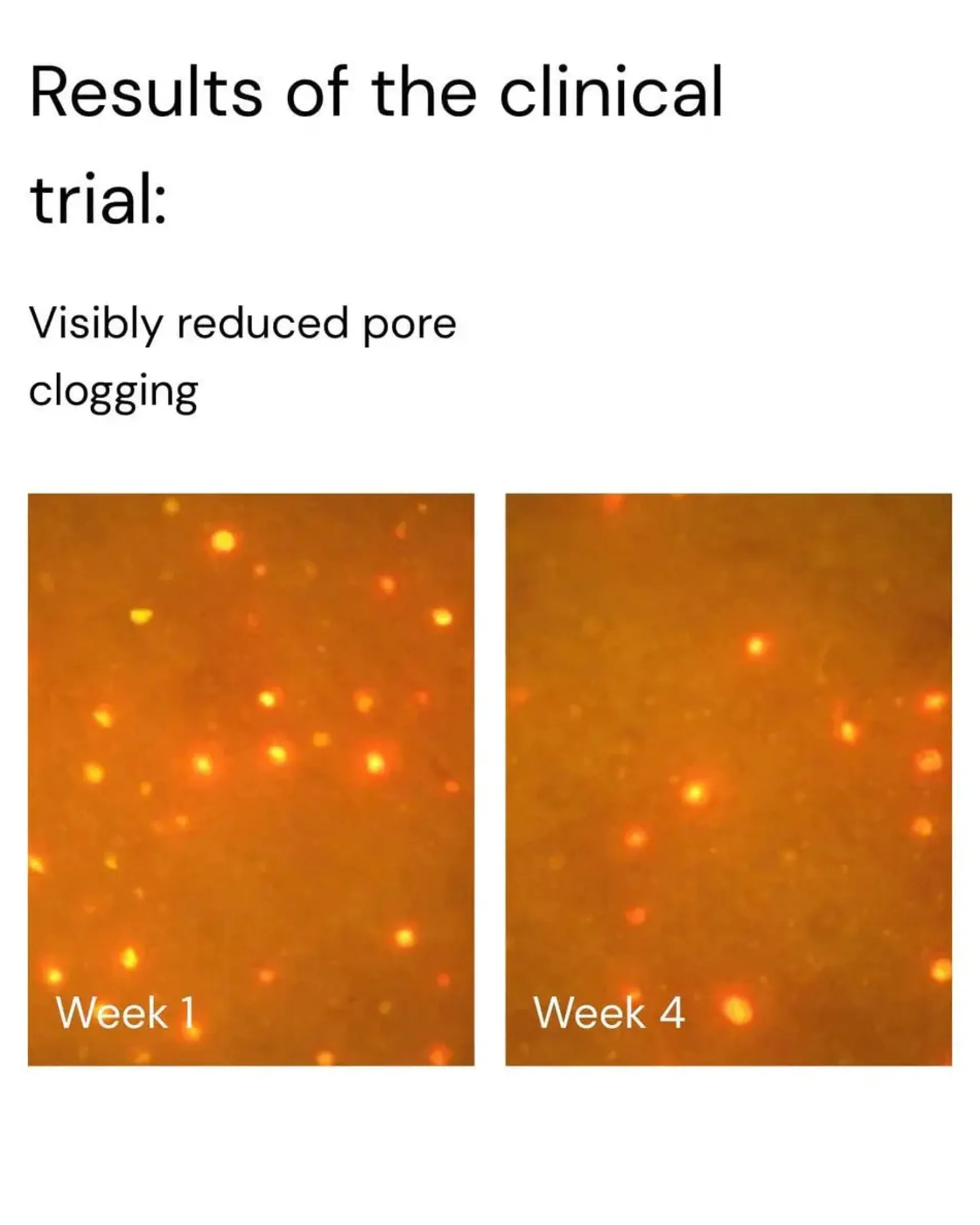 Pore & Line Refine Face Serum