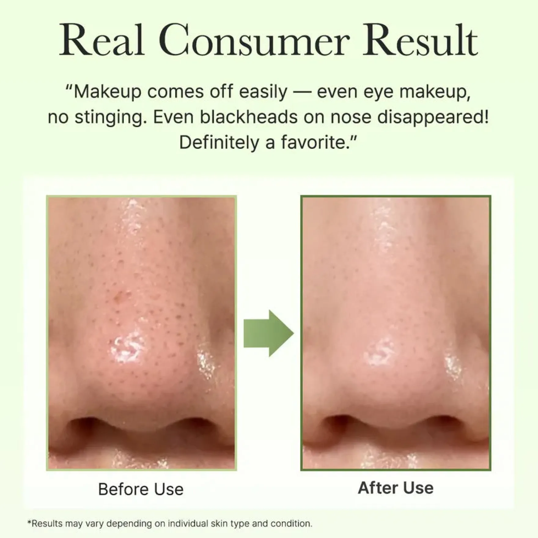 Pore Melt Phyto PDRN Cleansing Balm
