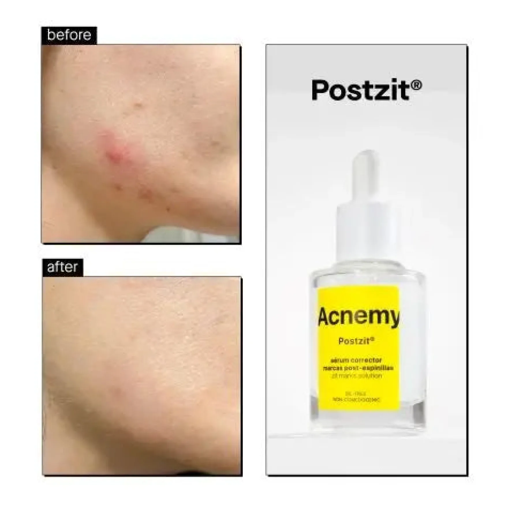 Postzit Zit Marks Solutions