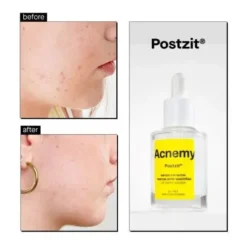 Postzit Zit Marks Solutions