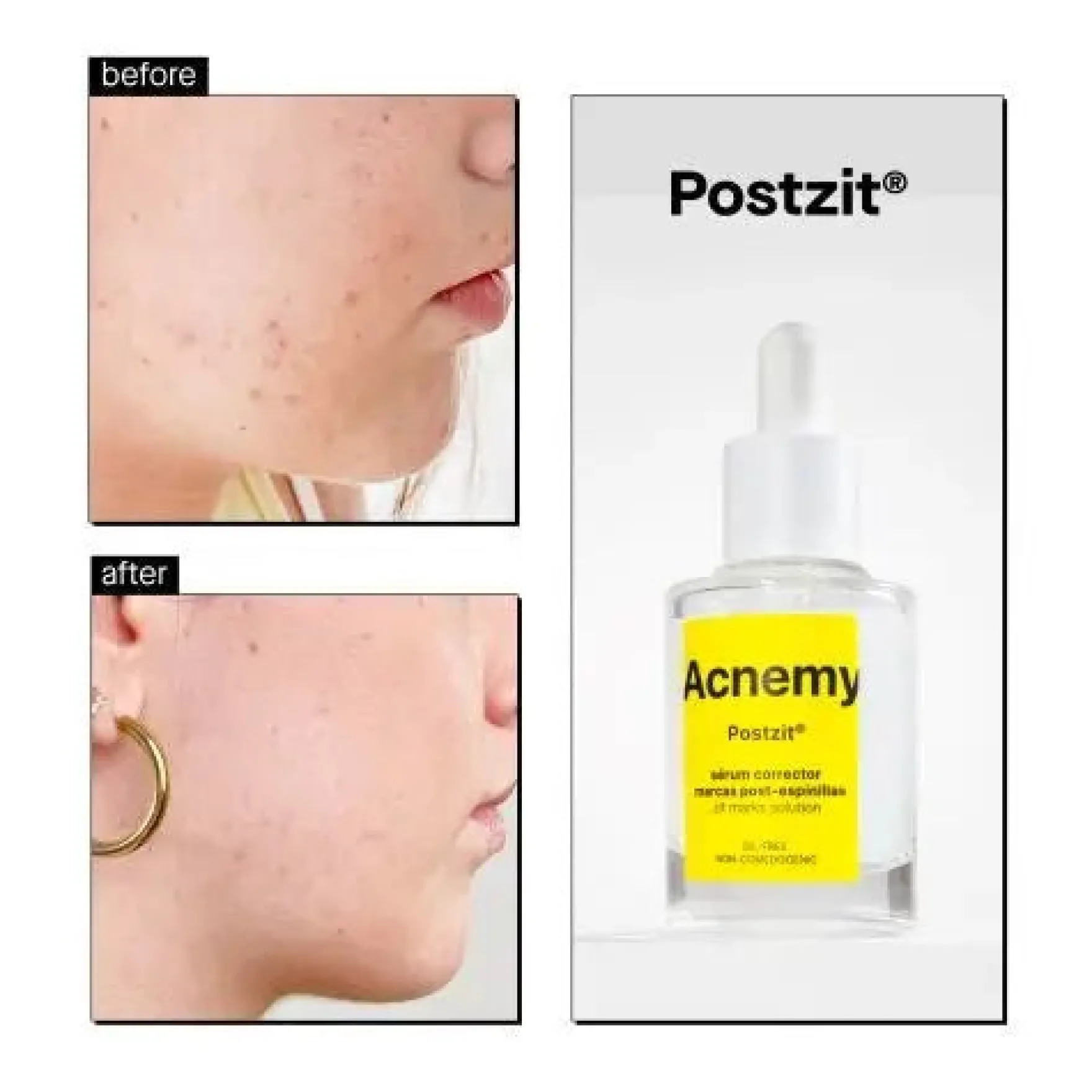Postzit Zit Marks Solutions