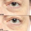 Pro-Tox Instant Fix Eye Firm