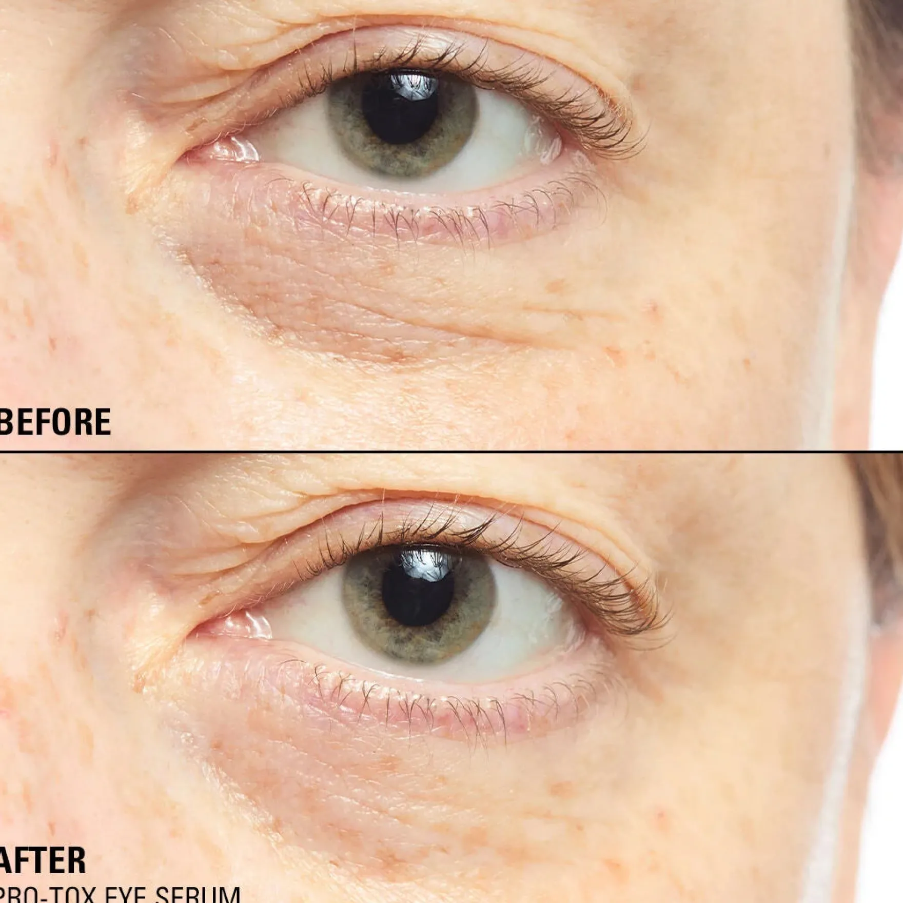 Pro-Tox Instant Fix Eye Firm