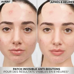 PureActive Pimple Patch