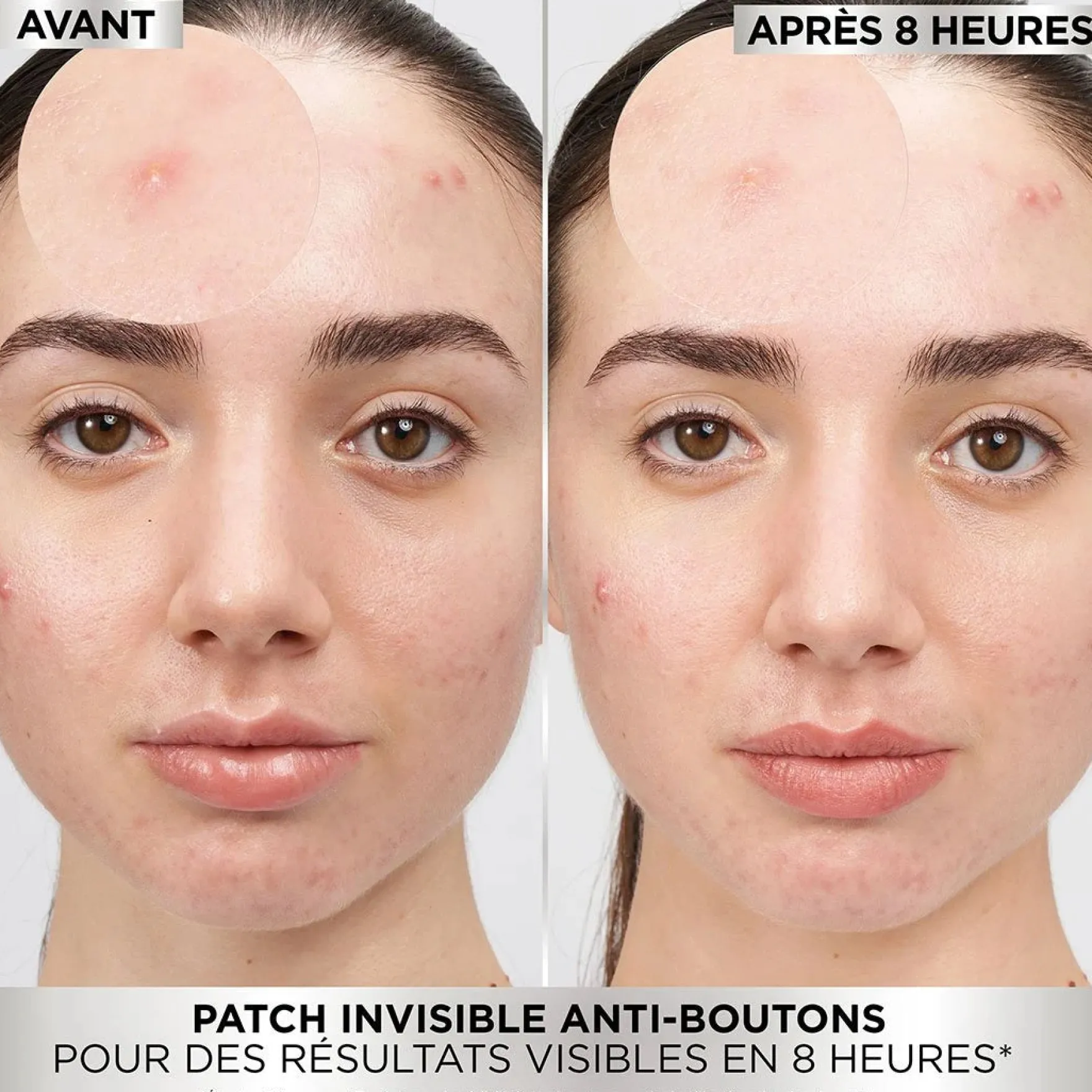 PureActive Pimple Patch
