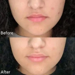 Real Calendula Peel Off Pack