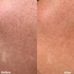 Retinol Pure Night Serum
