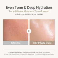 Ricefila Oil Toner