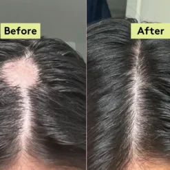 Rich Roots Hair & Scalp Oil Amla & Rosemary