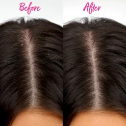 Scalp Detox Comb