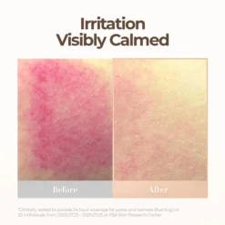 Skin Blemish Balm Intensive