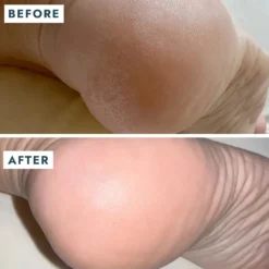 SoleMate Heel Repair Balm
