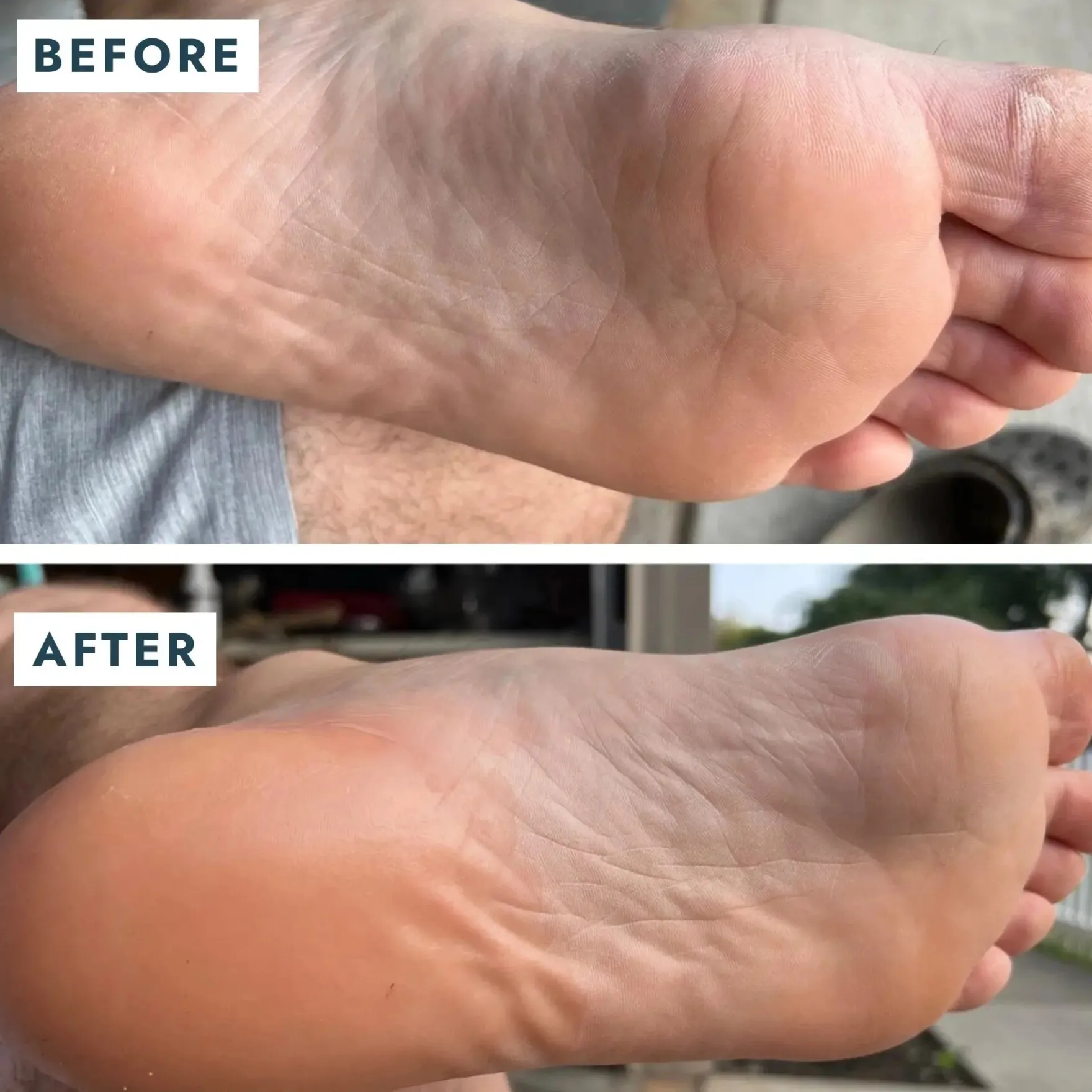 SoleMate Heel Repair Balm