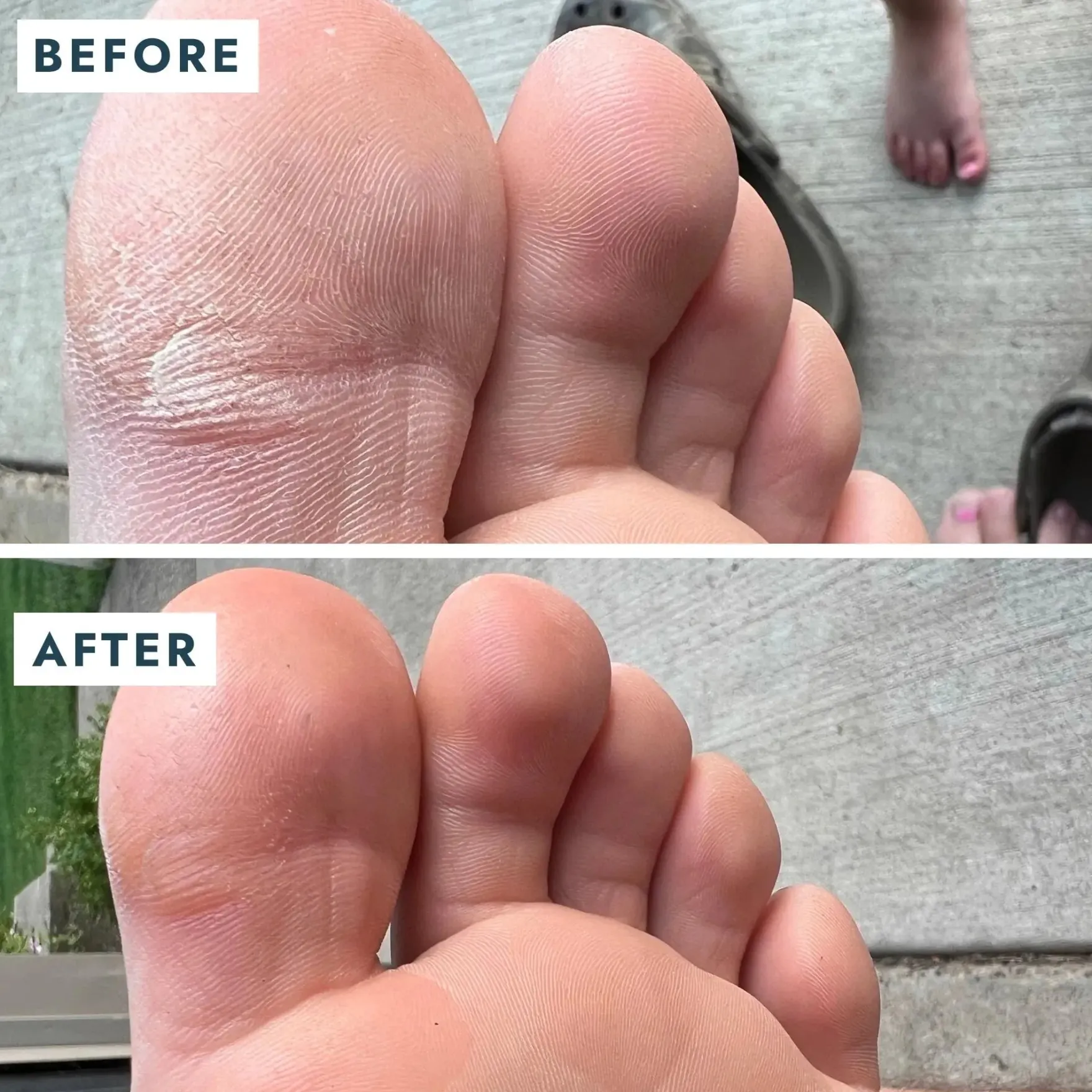 SoleMate Heel Repair Balm