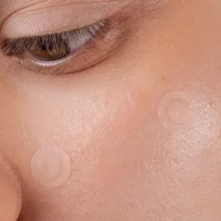 Spot the F Off Invisible Blemish Patches
