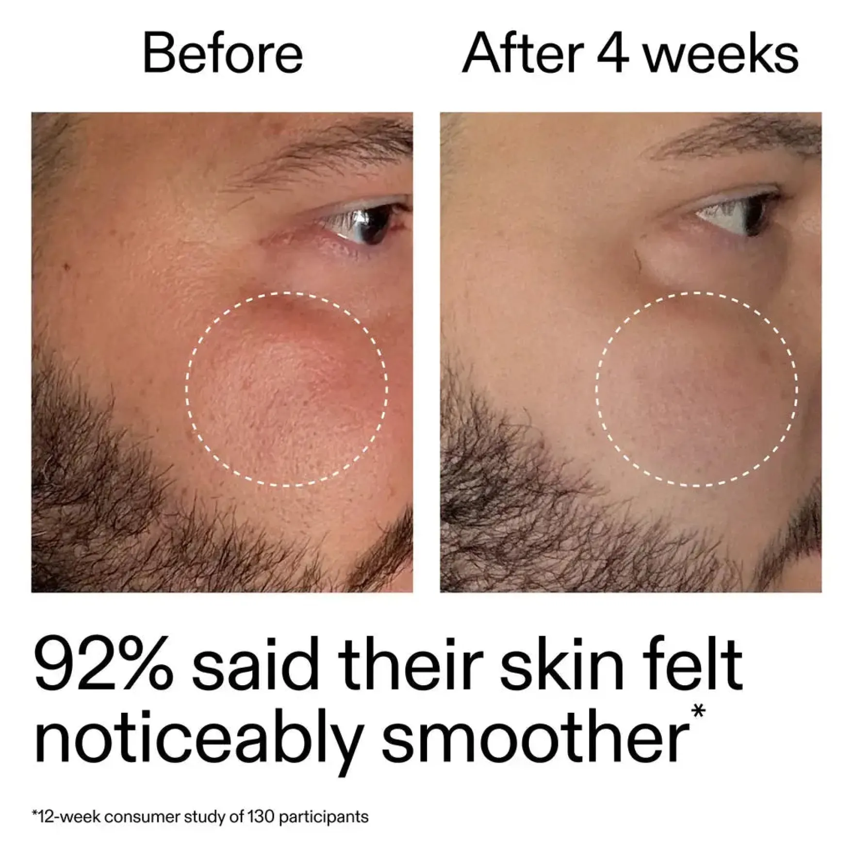 Starter Retinol Serum