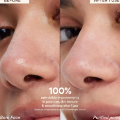 Super Volcanic Pore Clay Mask