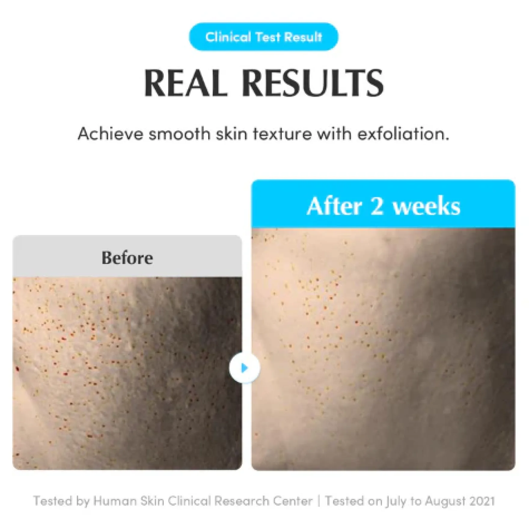 Swimming Pool Daily Facial Toner