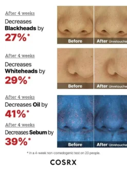 The AHA 2 BHA 2 Blemish Treatment Serum