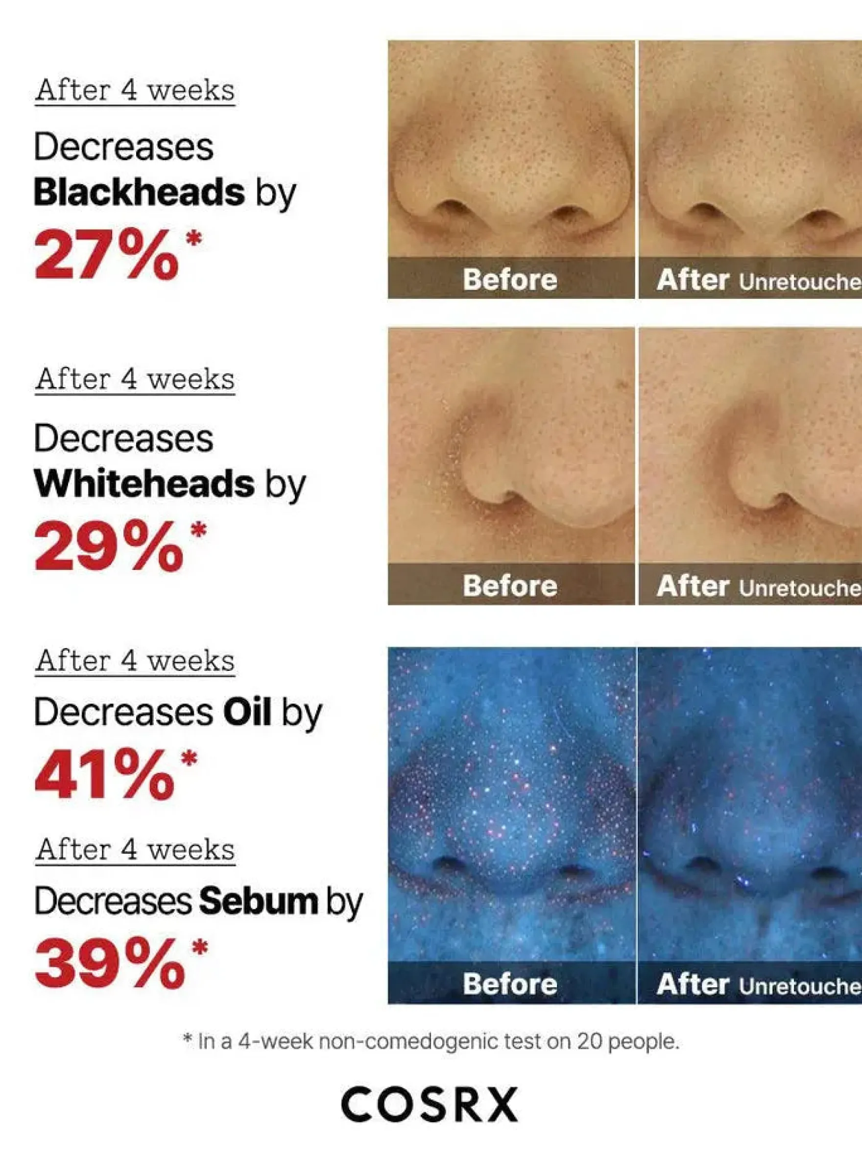 The AHA 2 BHA 2 Blemish Treatment Serum