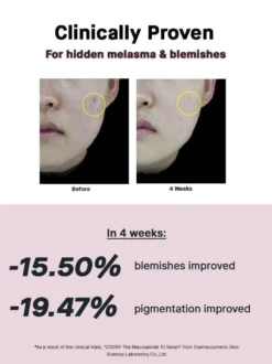 The Niacinamide 15 Serum