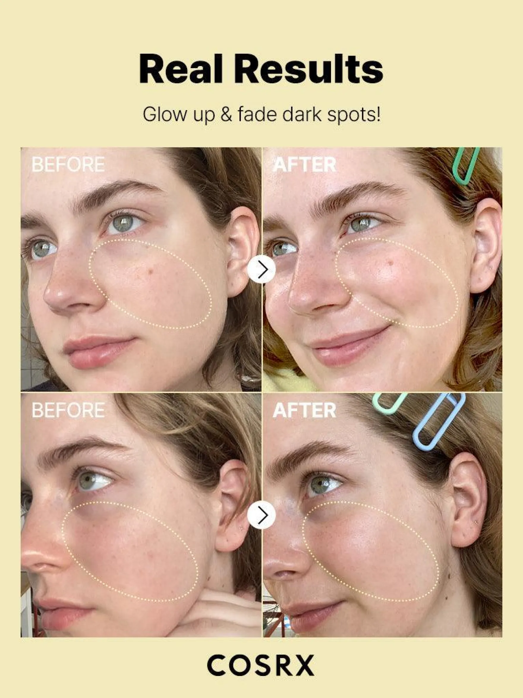 The Vitamin C 23 Serum