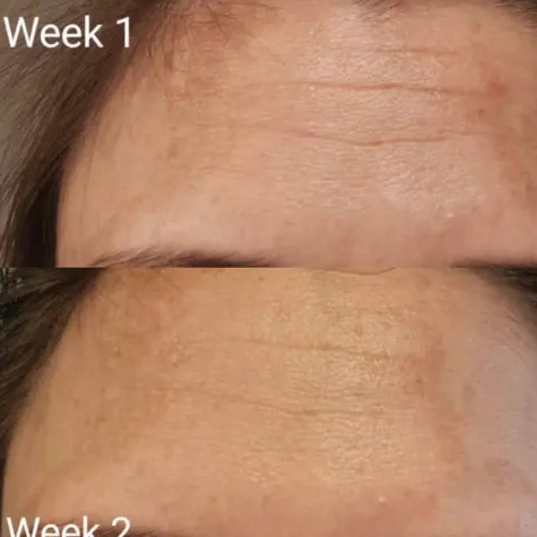 Tripeptide Collagen