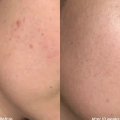 Triple AHA Cleanser
