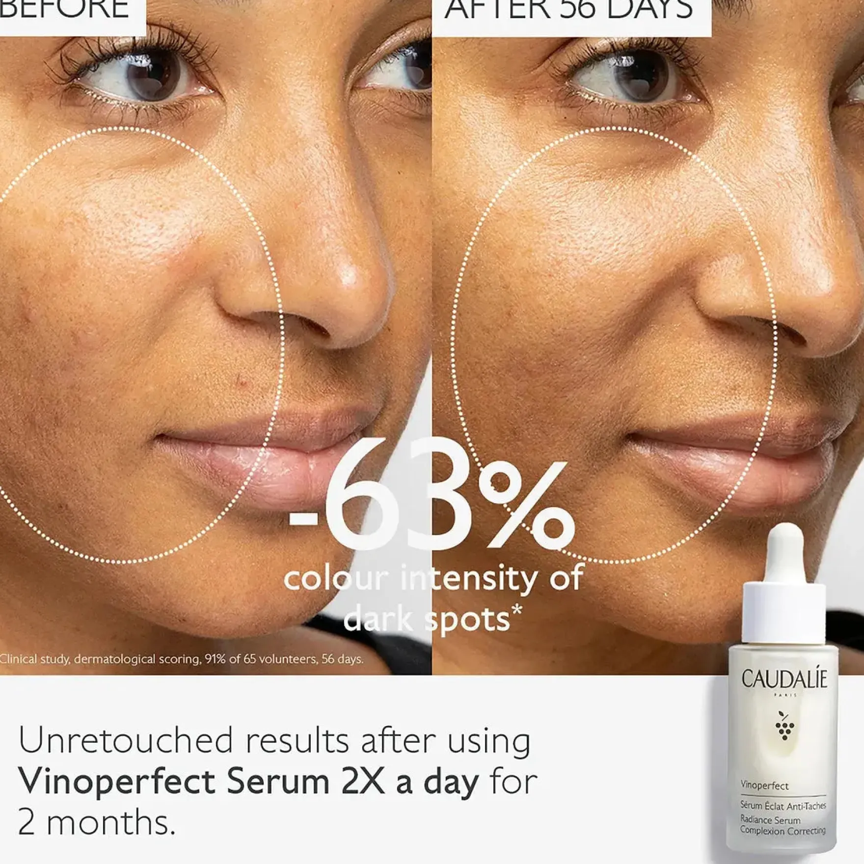 Vinoperfect Radiance Serum Complexion Correcting
