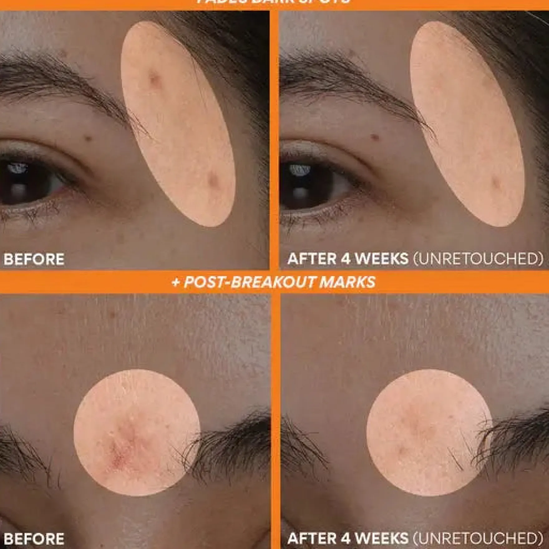 Vitamin C Green Tea Enzyme Brightening Serum