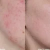 Vitamine C Serum