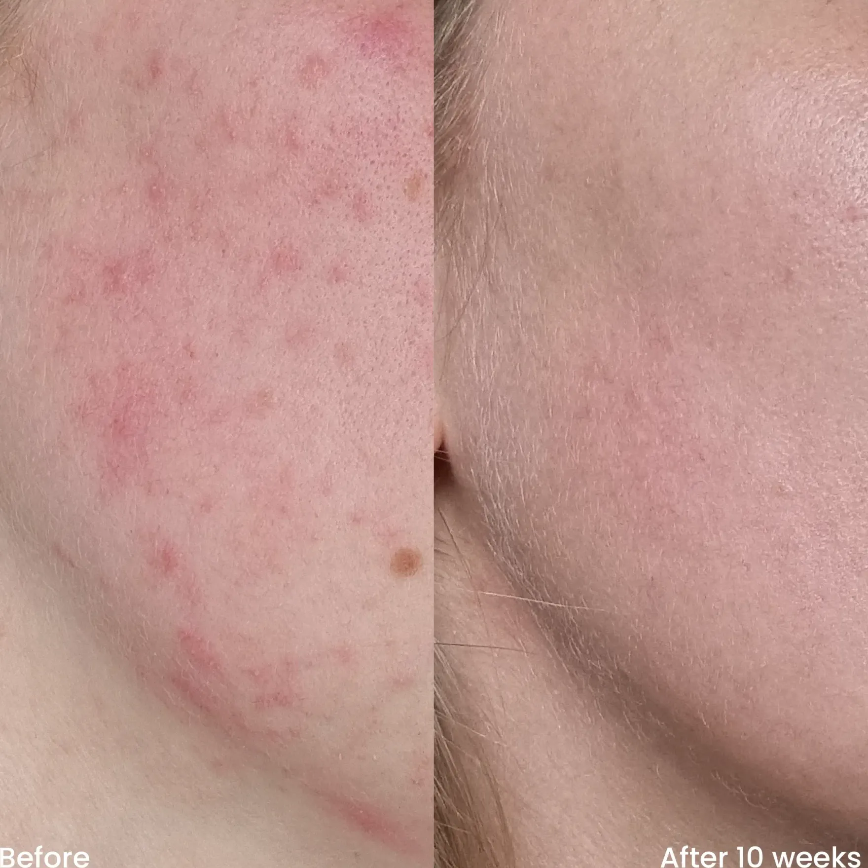 Vitamine C Serum