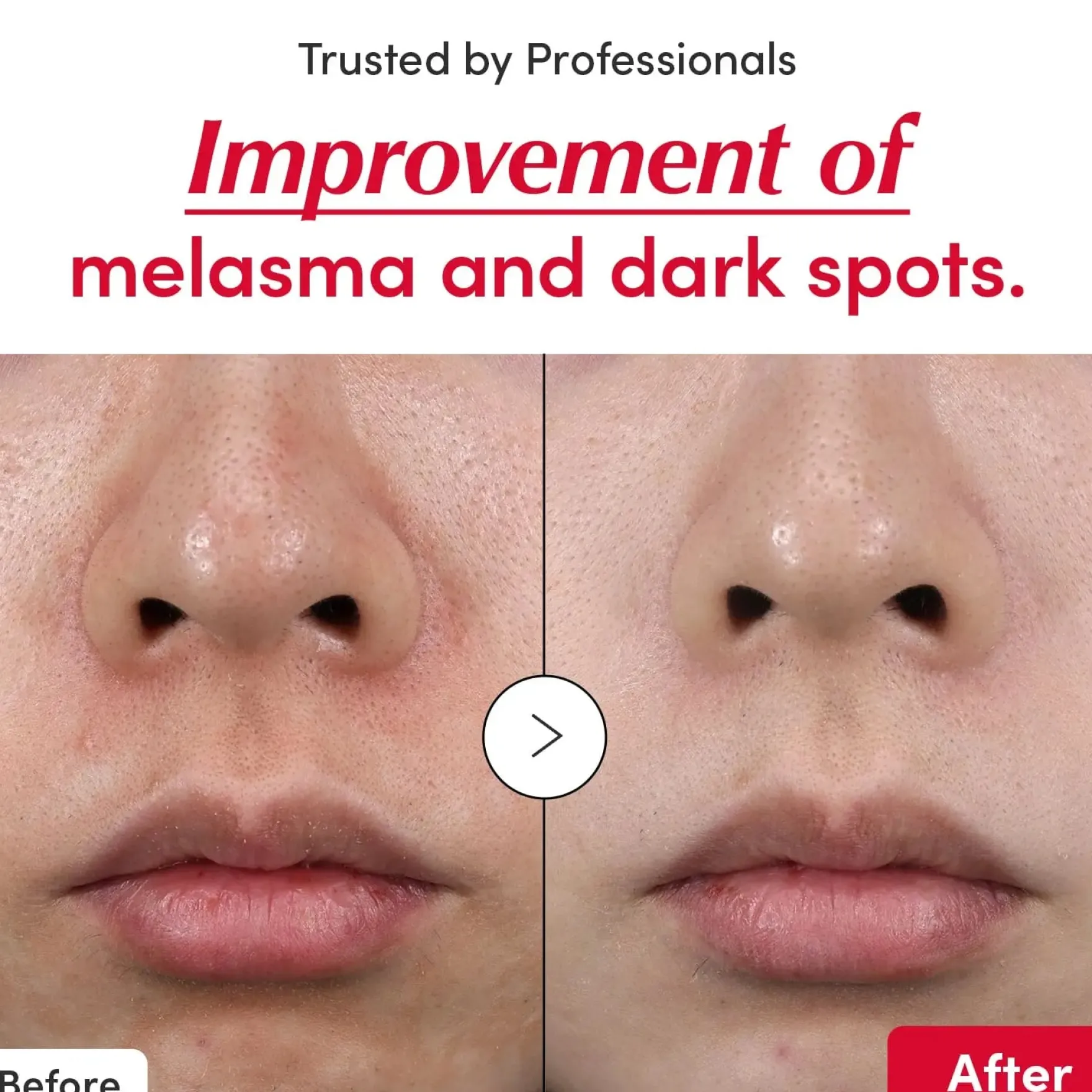 Vitamin Illuminating Serum