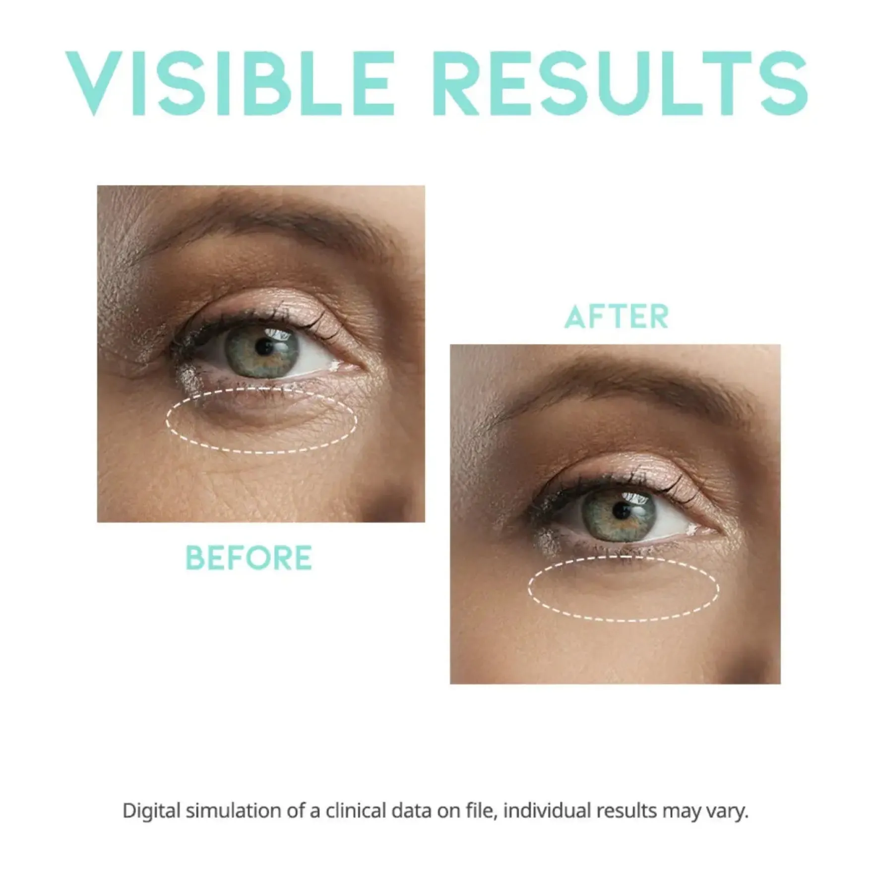 Wrinkle Lift Eye Serum