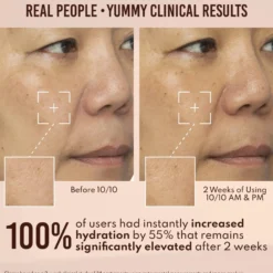 Yummy Skin 10/10 Barrier Boost